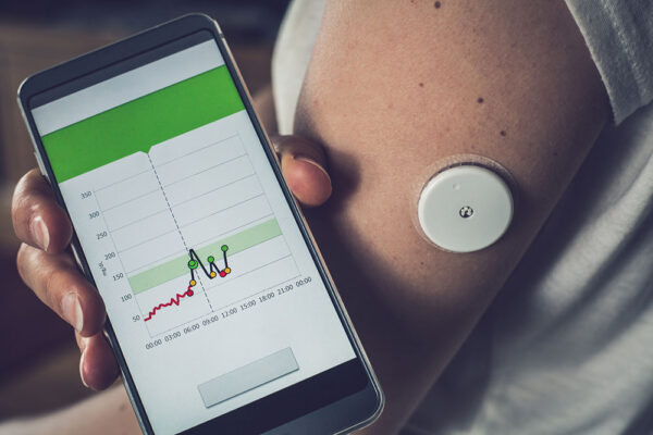 Patient checking glucose level with a remote sensor and mobile phone.