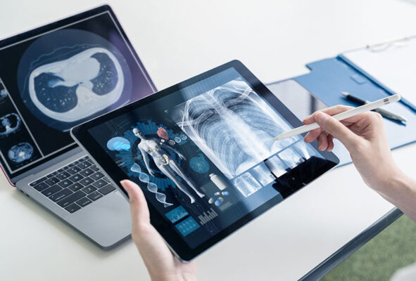 A person holds a tablet displaying medical images of a chest X-ray and anatomy diagram with a laptop showing a CT scan beside them on a desk. 